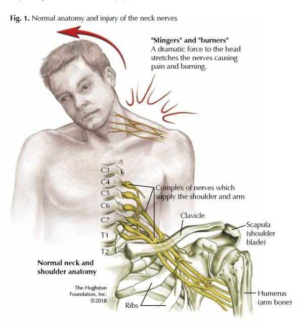 how-to-determine-which-nerve-in-neck-that-s-causing-pain-or-numbness-in